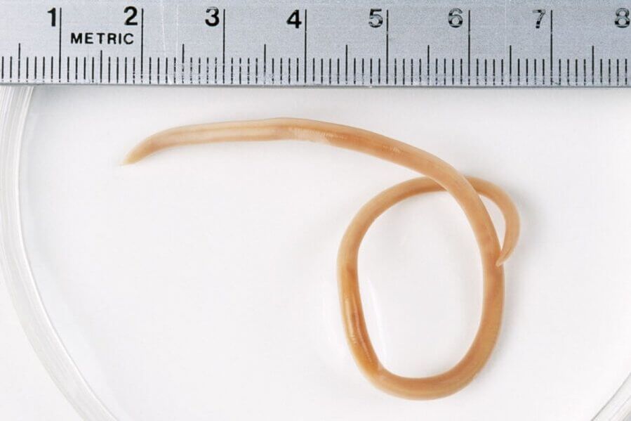 Ascaris è un verme rotondo che vive nel corpo umano